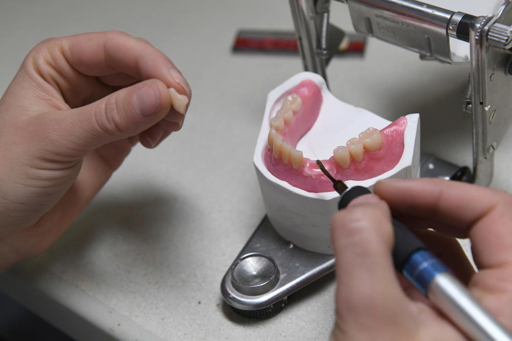 Zähne platzieren und Zahnfleisch modellieren